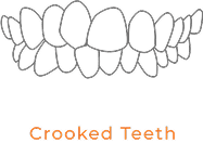 Crooked Teeth