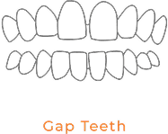 Gap Teeth