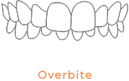 Overbite