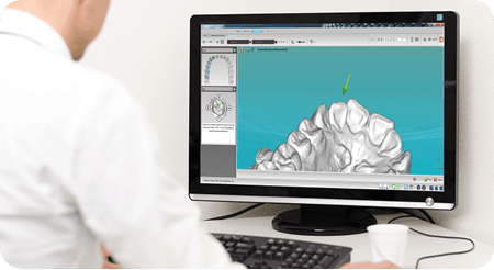 STL File 3D Printing