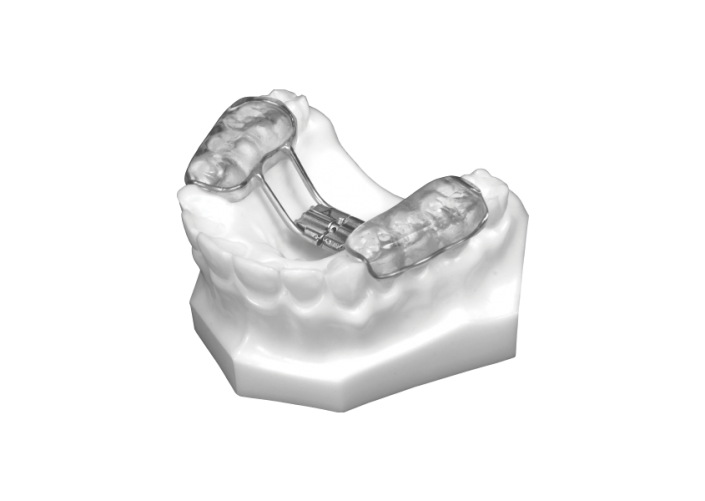 Bonded RPE (Upper Only)