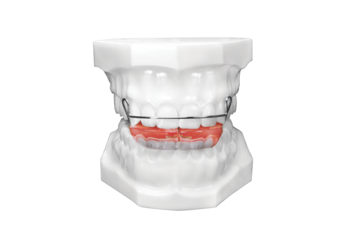 Bionator - To Open or Close