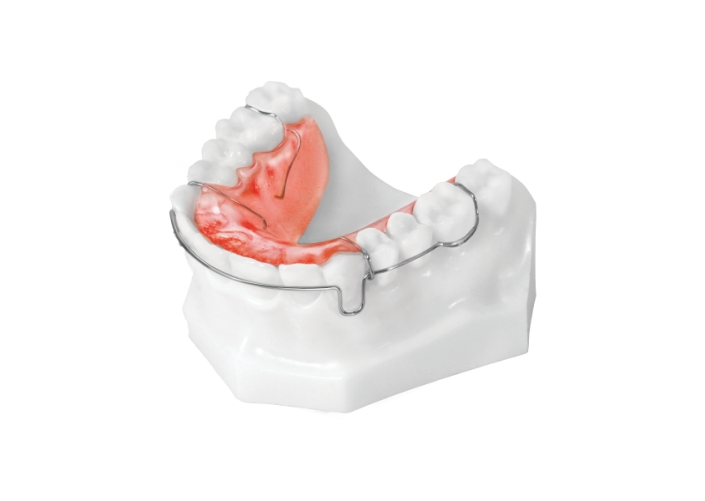 Circumferential Retainer (Upper)